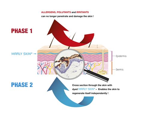 Regeneration Of The Skin Barrier Marly Skin