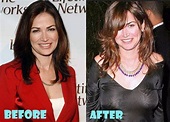 Kim Delaney Plastic Surgery Before And After Pictures | Celebrities ...