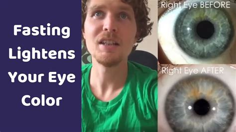 Fasting Lightens And Changes Your Eye Color Iridology Youtube