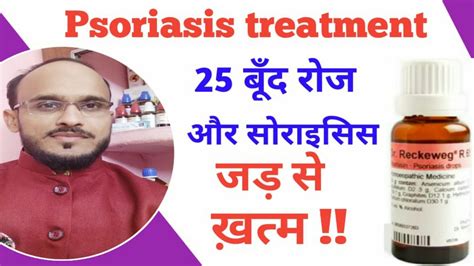 Homeopathic Medicine For Psoriasis Explain Youtube