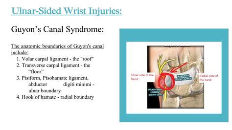 Ppt Ulnar Sided Wrist Pain In The Athlete Powerpoint Presentation