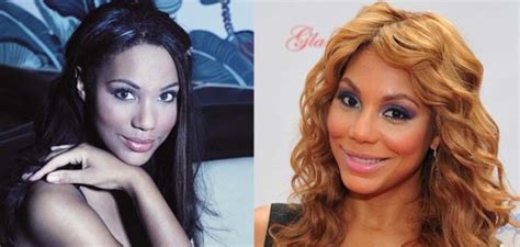 Has Tamar Braxton Had Plastic Surgery