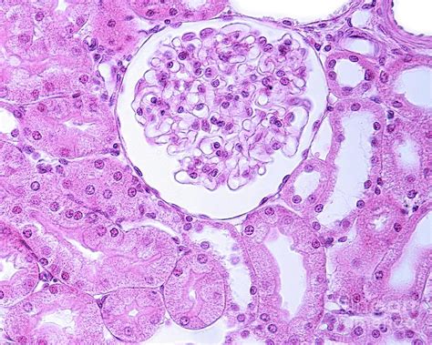 Kidney Glomerulus Photograph By Jose Calvoscience Photo Library