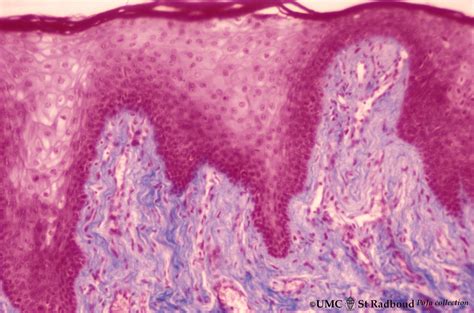 Vermilion Border Of Lip Histology