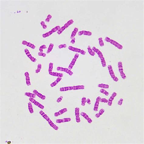 Pcs Set Human Chromosomes Prepared Microscope Slides Factory Wholesale