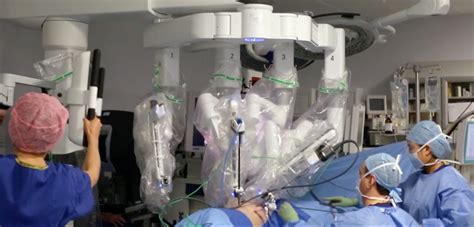 Bbc Doc Looks At First Robotic Oesophagectomy Surgical Oncology