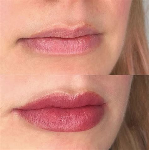 Freckles And Lip Blush — Laurel In 2021 Lip Permanent Makeup Lip Color