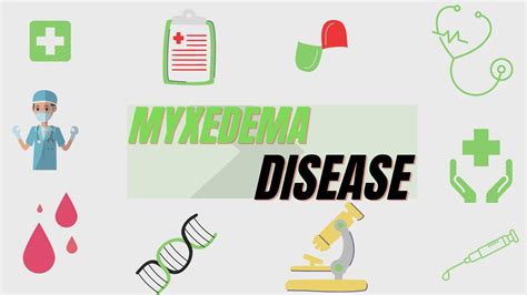 Myxedema Definition Symptoms Diagnosis Treatment Youtube