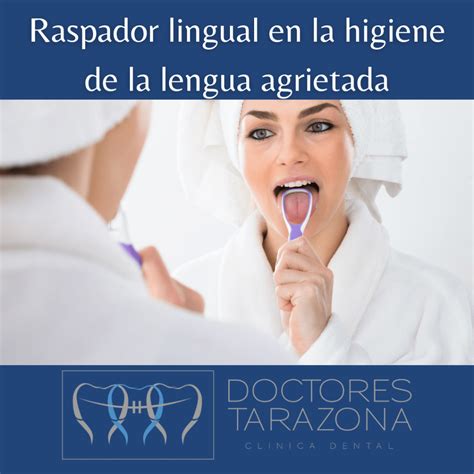 Lengua Agrietada ¿es Tu Caso Clínica Dental Doctores Tarazona