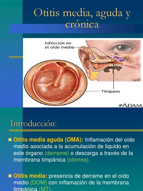 Otitis Media Aguda Y Cr Nica Epidemiología Oído
