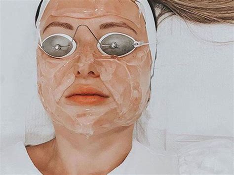 These Are The Best Laser Treatments For Acne Scars