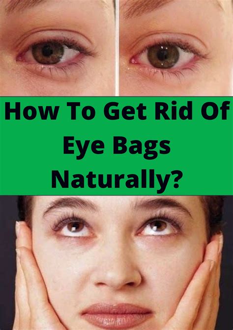 How To Get Rid Of Eye Bags Sagging Skin Skin Best Skin Care Routine