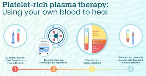 Platelet Rich Plasma Therapy Using Your Own Blood To Heal