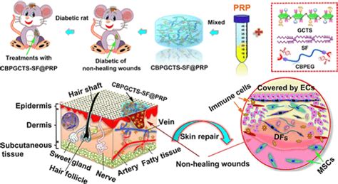 Improving Chronic Diabetic Wound Healing Through An Injectable And Self
