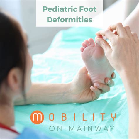 Pediatric Foot Deformities Mobility On Mainway