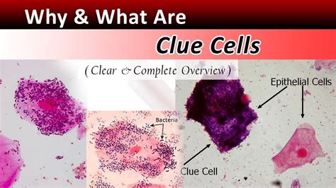 What Are Clue Cells Clear And Complete Overview Youtube