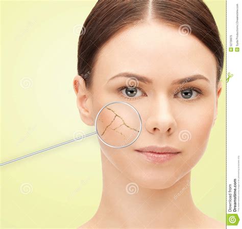 Woman Face With Dry Dehydrated Skin Stock Image Image Of Imperfect