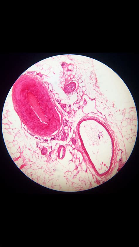 Veins And Arteries Under A Microscope Medical Lab Technician Magnified Images Fearfully