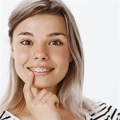 How Long It Take To Remove Braces What To Know About Brace Removal
