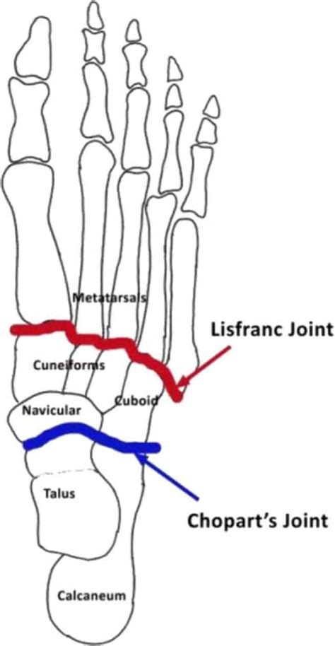 Lisfranc injury recovery time nfl. Lisfranc Injuries Of The Foot: An Injury You Must Respect ...