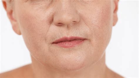 Smokers Lines How To Get Rid Of Upper Lip Lines And Wrinkles Centre