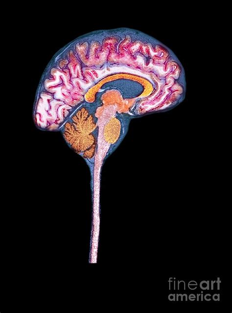 Normal Human Brain Mri Scan Photograph By Du Cane Medical Imaging Ltd