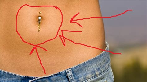 How To Get Rid Of Belly Button Piercing Infection Bump Youtube