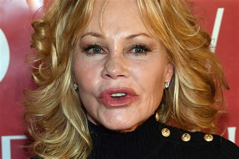 Melanie Griffith Courageuse Assume Son Visage Transformé Par Un Cancer De La Peau Femme Actuelle