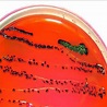 Morphology & Culture Characteristics of Escherichia coli (E. coli)