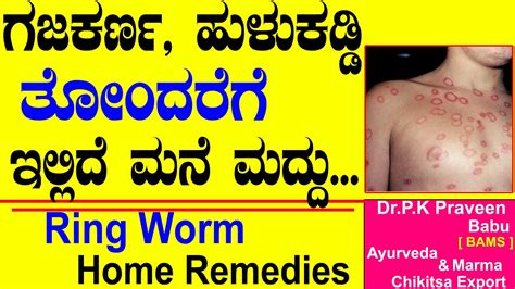 Gajakaran In Kannnada Ringworm Infection Treatment In Ayurveda