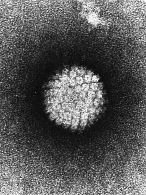 Electron Micrograph Of Human Papillomavirus Biology Of Human World Of