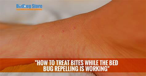 How To Treat Bites While The Bed Bug Repelling Is Working