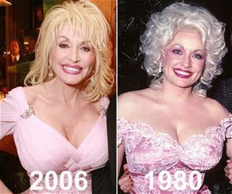 Dolly Parton Plastic Surgery Before and After Photos ...