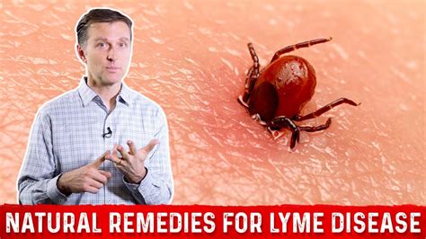 Natural Remedies For Lyme Disease