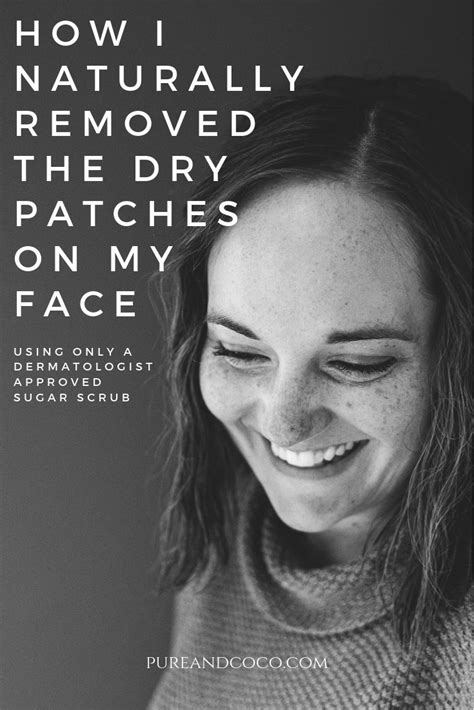 How To Treat Dry Patches On Your Face Using A Dermatologist Approved S