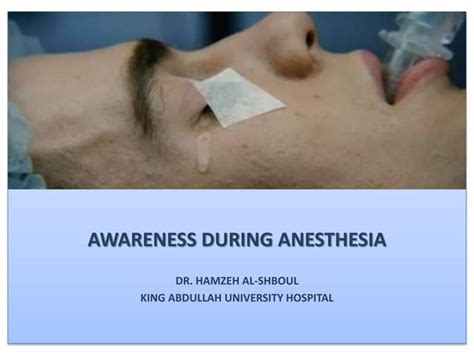Awareness During Anesthesia Ppt