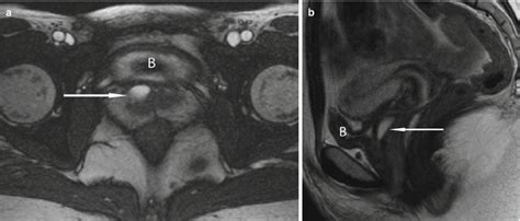 Cross Sectional Imaging Of The Female Urethra Springerlink