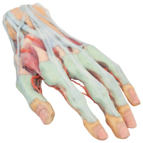 3 D Printed Human Superficial Hand Dissection Model