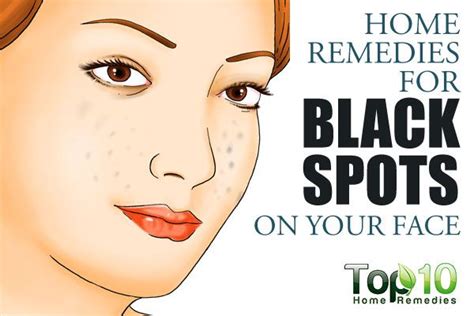 Home Remedies For Black Spots On Face Top 10 Home Remedies
