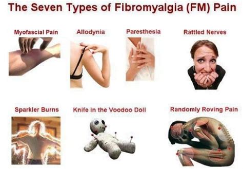 The Seven Types Of Fibromyalgia Jointpainrelief Fibromyalgia Pain