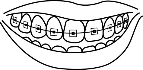 Oral Orthodontic Flat Outline Vector Teeth Braces Png