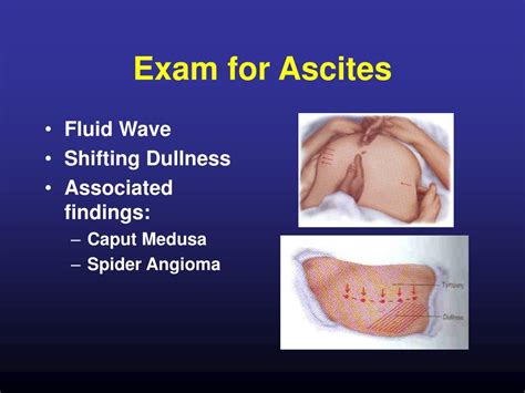 Ppt The Acute Abdomen Powerpoint Presentation Free Download Id3139688