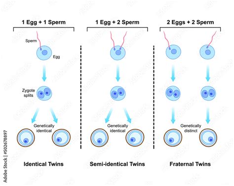 scientific designing of differences between monozygotic and dizygotic twins formation identical