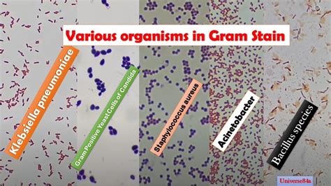Various Bacteria Gram Stain Microscopygram Positive Rodsgram Negative