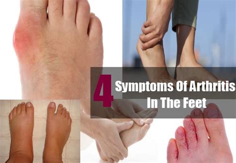 4 Common Symptoms Of Arthritis In The Feet Five Common