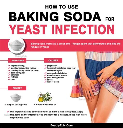 5 Simple Ways To Get Rid Of Yeast Infection Fast With Baking Soda