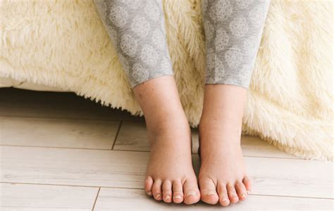 5 Ways To Manage Swollen Legs And Feet During Pregnancy Your