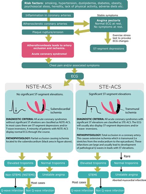 Unstable Angina Ecg