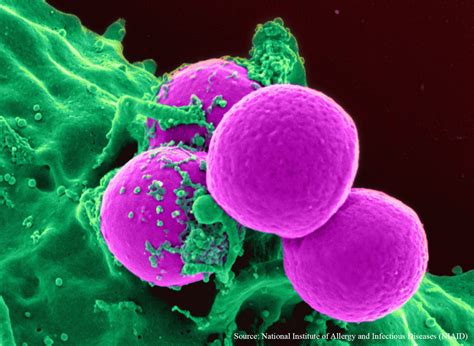 New Strategies Released To Combat Mrsa In Hospitals Infection Control