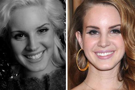 Lana Del Rey Before She Had Plastic Surgery Cosmetic Surgery Nose